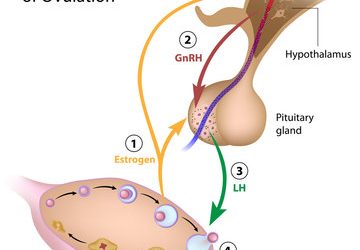 El Síndrome de Ovario Poliquístico: Más allá de la ovulación