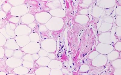 Más allá de la báscula: la grasa como un órgano inflamatorio
